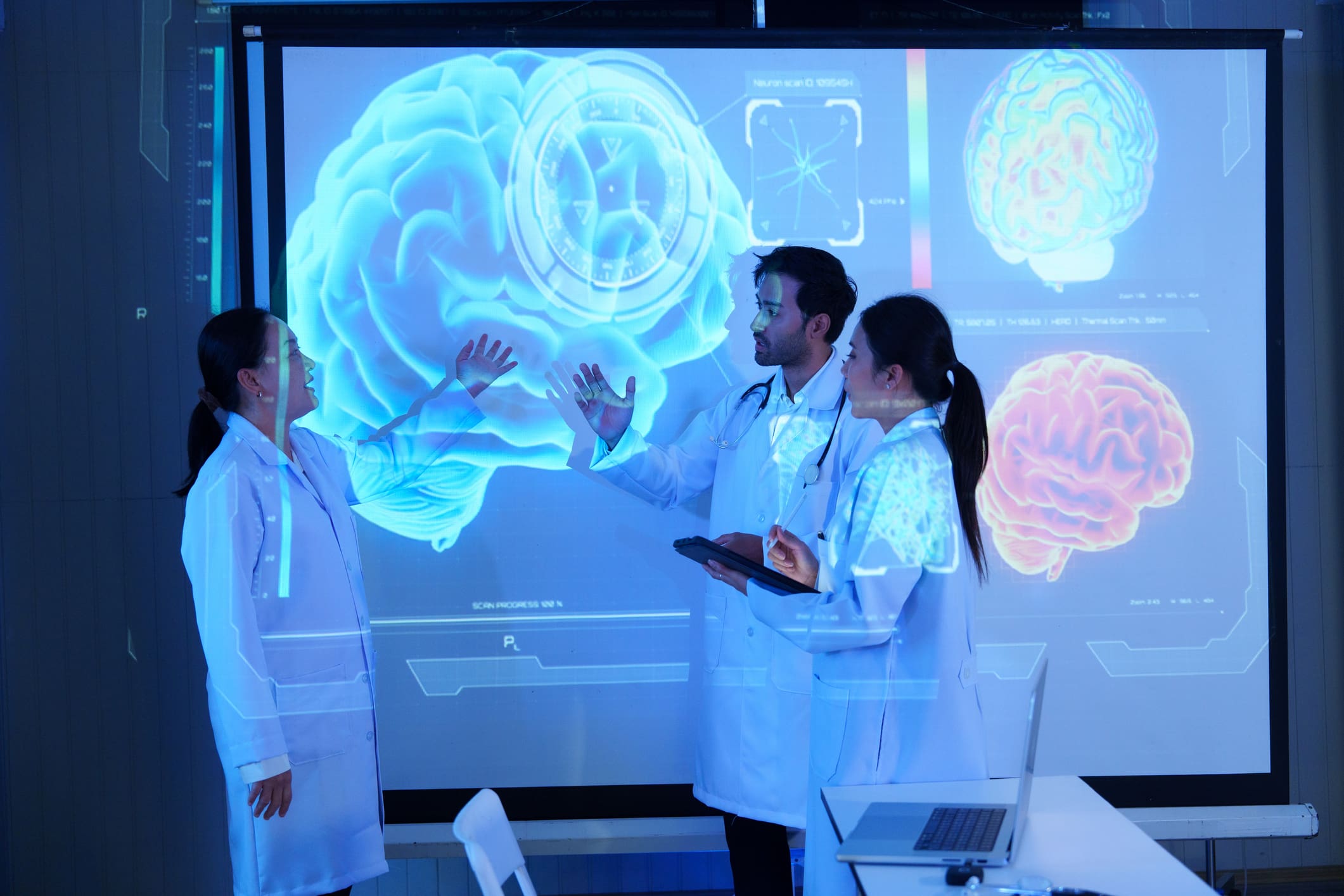 Researchers analyzing brain scan