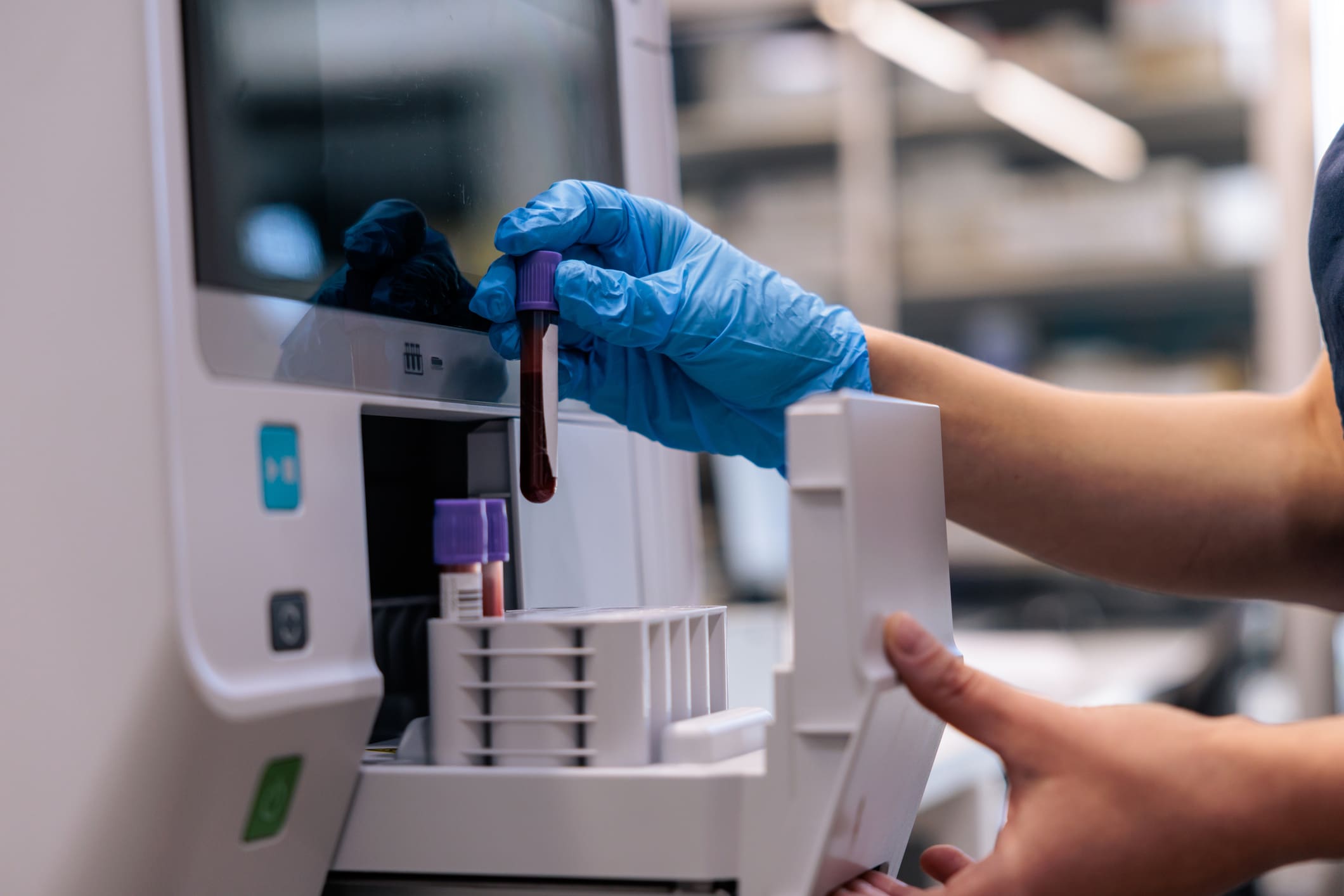 Close-up of a gloved hand inserting a blood sample tube into an automated medical analyzer in a clinical lab. The image conveys precision, sterile technique, and advanced diagnostic technology used in modern healthcare and laboratory testing.