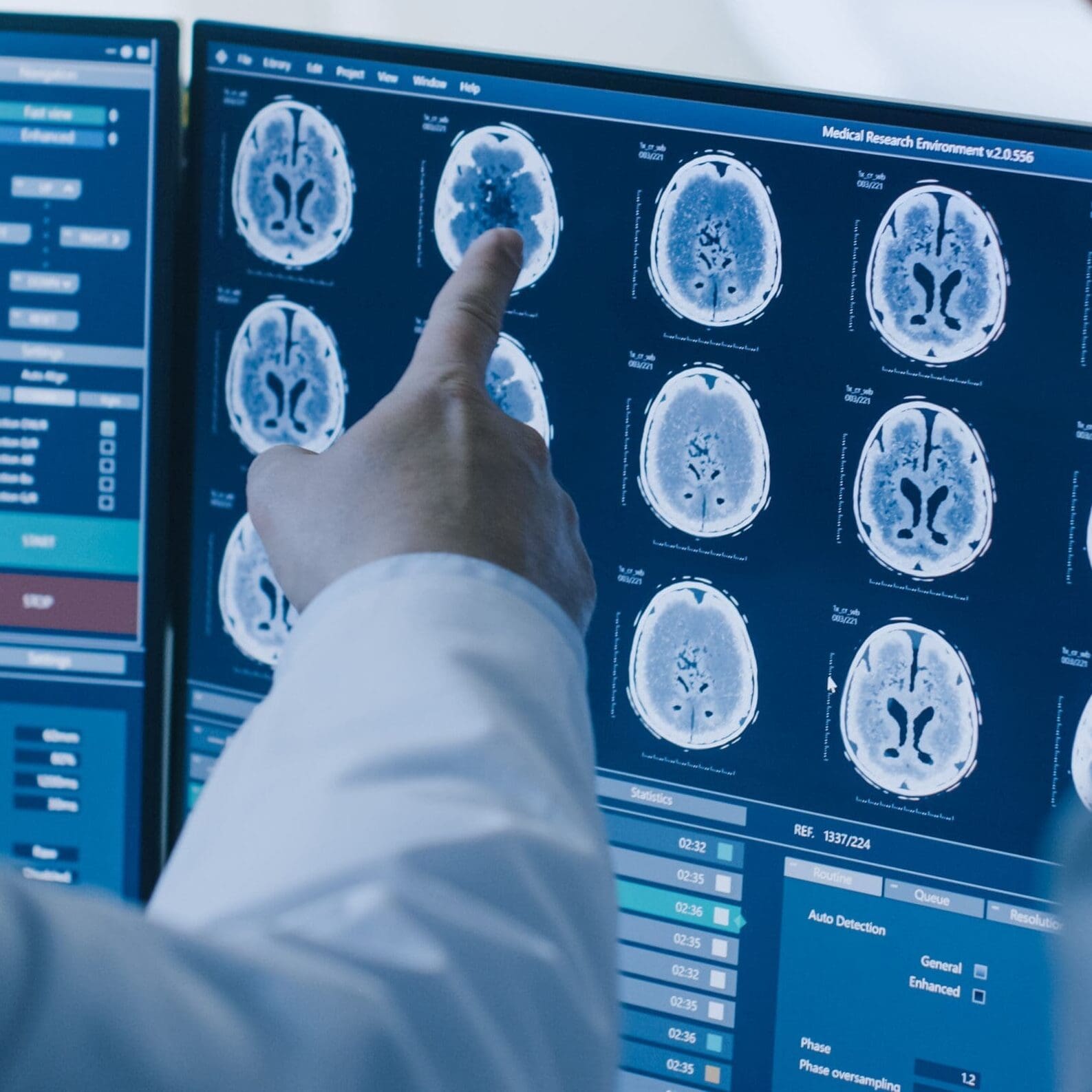 In Control Room Doctor and Radiologist Discuss Diagnosis while Watching Procedure and Monitors Showing Brain Scans Results, In the Background Patient Undergoes MRI or CT Scan Procedure.