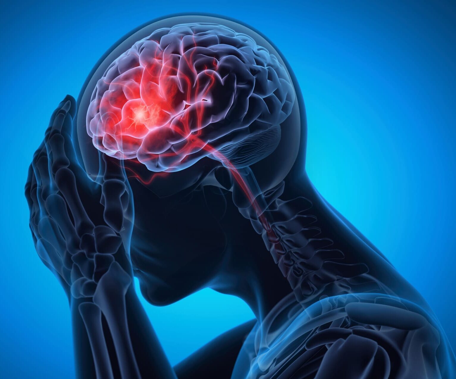 Man with a headache -  Brain Stroke -  X ray 3D Illustration with blue background