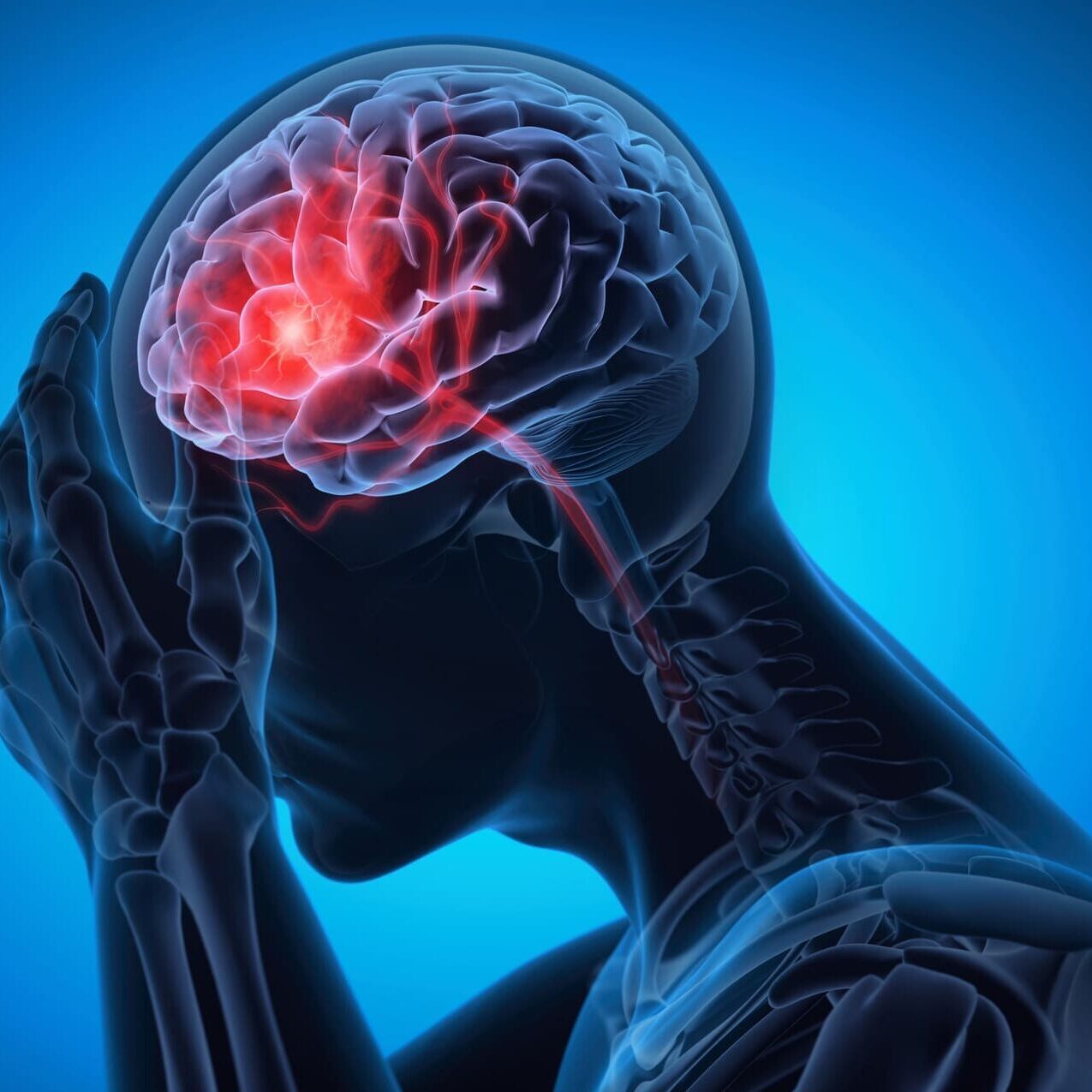 Man with a headache -  Brain Stroke -  X ray 3D Illustration with blue background